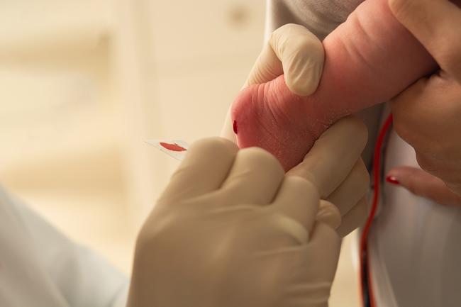 baby getting blood spot test